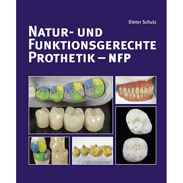 Natur- und funktionsgerechte Prothetik - NFP, Dieter Schulz