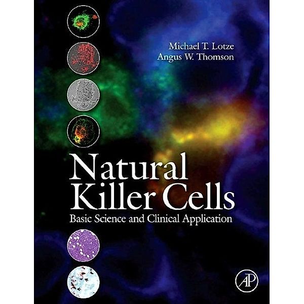 Natural Killer Cells, Michael Lotze