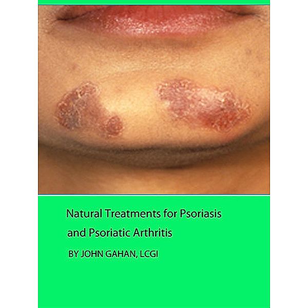 Natural Treatments for Psoriasis and Psoriatic Arthritis, John Gahan