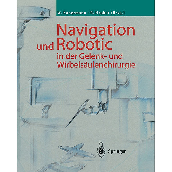 Navigation und Robotic in der Gelenk- und Wirbelsäulenchirurgie