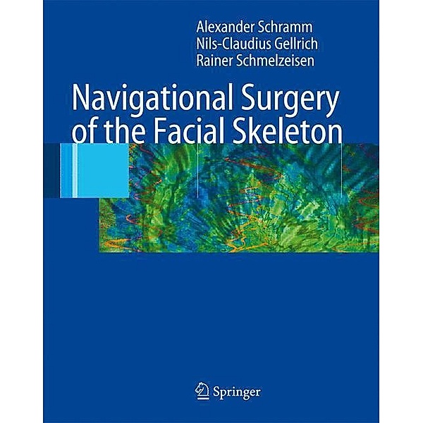 Navigational Surgery of the Facial Skeleton, Alexander Schramm, Nils-Claudius Gellrich, Rainer Schmelzeisen