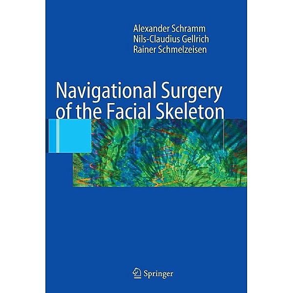 Navigational Surgery of the Facial Skeleton, Alexander Schramm, Nils-Claudius Gellrich, Rainer Schmelzeisen