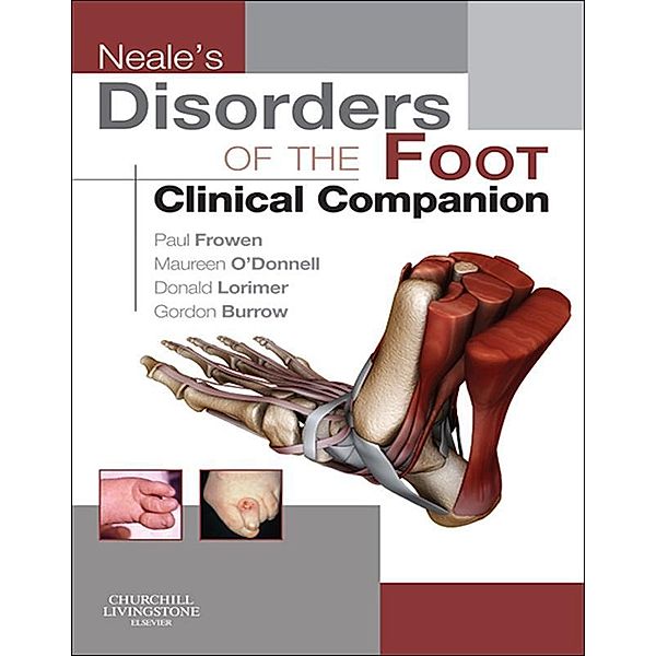 Neale's Disorders of the Foot, Paul Frowen, Maureen O'Donnell, J. Gordon Burrow