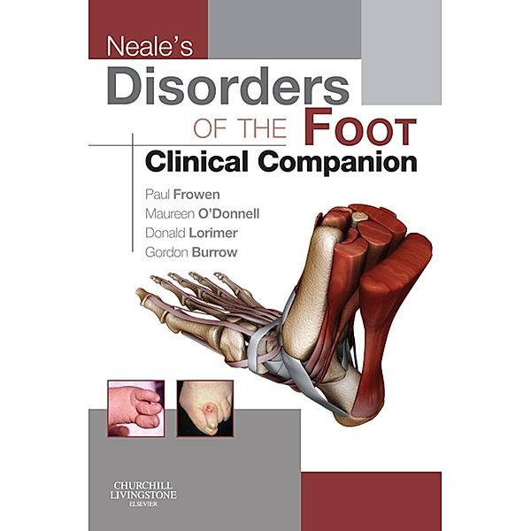 Neale's Disorders of the Foot Clinical Companion, Paul Frowen, Maureen O'Donnell, J. Gordon Burrow, Donald L. Lorimer