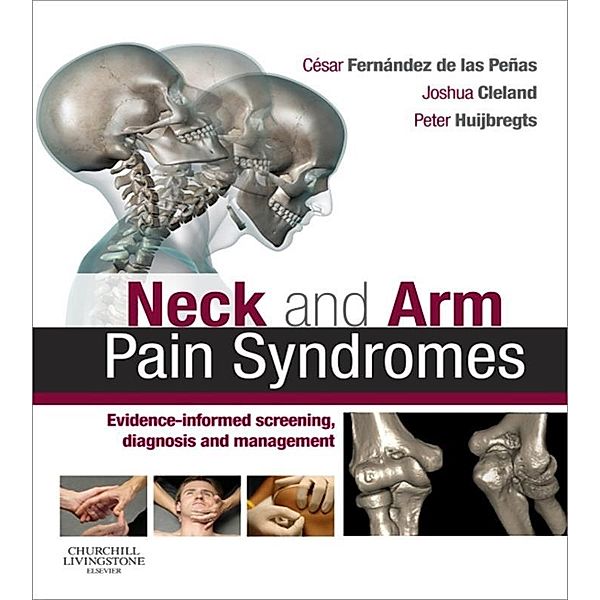 Neck and Arm Pain Syndromes E-Book, Cesar Fernandez de las Penas, Joshua Cleland, Peter A. Huijbregts