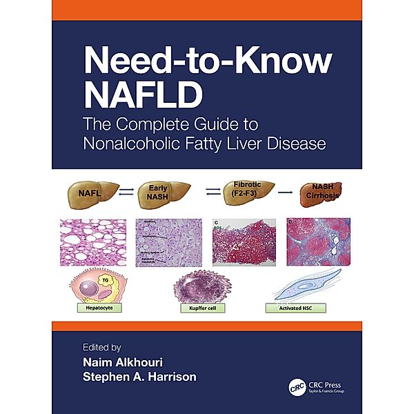 Need-to-Know NAFLD