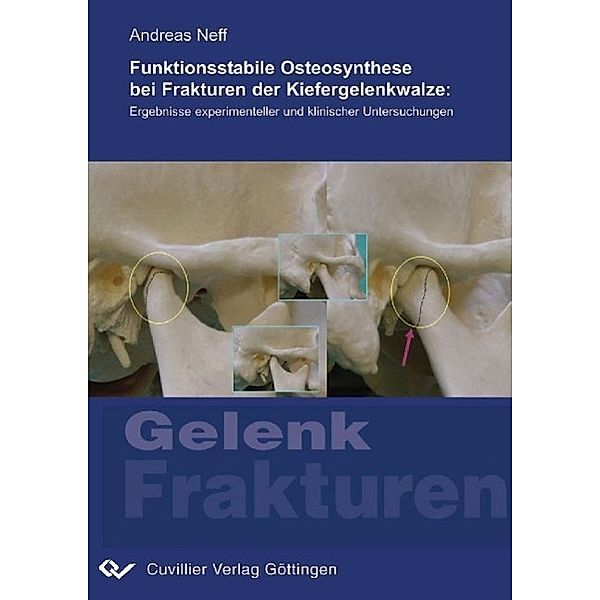 Neff, A: Funktionsstabile Osteosynthese bei Frakturen der Ki, Andreas Neff