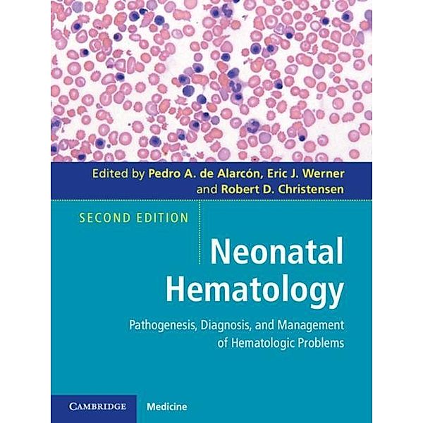 Neonatal Hematology