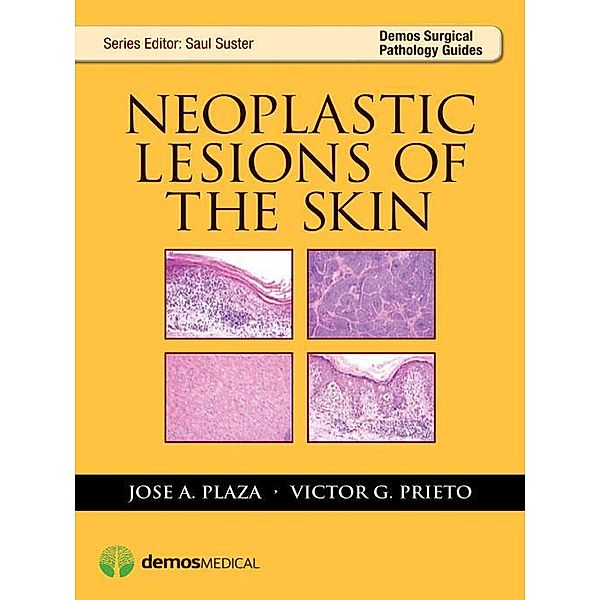 Neoplastic Lesions of the Skin / Demos Surgical Pathology Guides, Jose A. Plaza, Victor G. Prieto