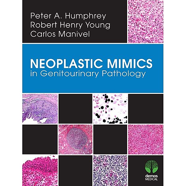 Neoplastic Mimics in Genitourinary Pathology / Pathology of Neoplastic Mimics, Peter A. Humphrey, J. Carlos Manivel, Robert H. Young