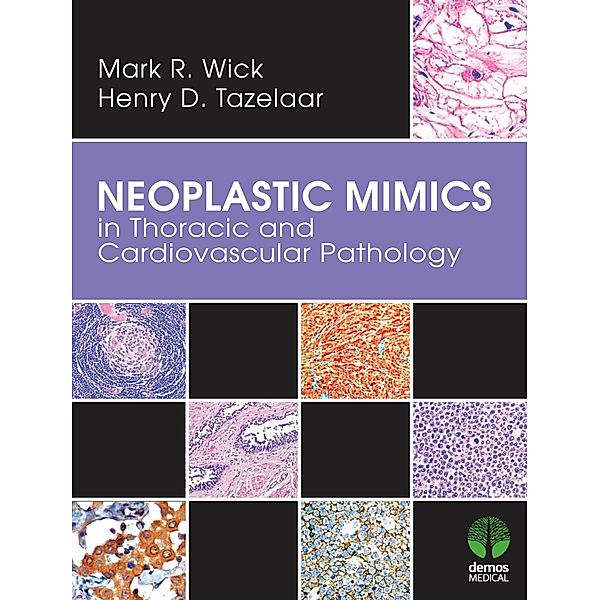 Neoplastic Mimics in Thoracic and Cardiovascular Pathology / Pathology of Neoplastic Mimics, Henry D. Tazelaar, Mark R. Wick