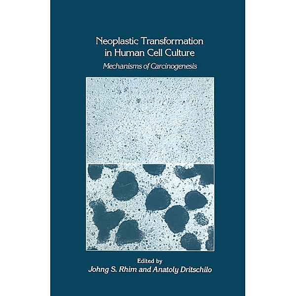 Neoplastic Transformation in Human Cell Culture, Johng S. Rhim, Anatoly Dritschilo