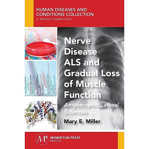 Nerve Disease ALS and Gradual Loss of Muscle Function, Mary E. Miller