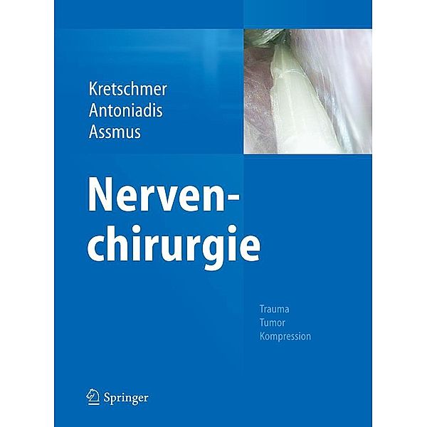 Nervenchirurgie