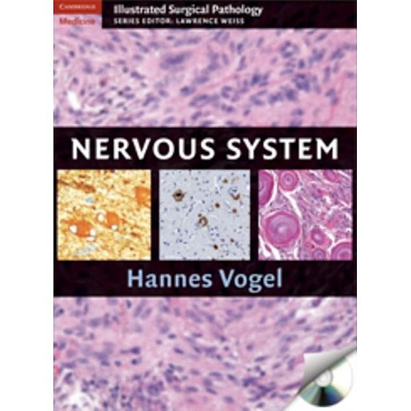 Nervous System, Hannes Vogel