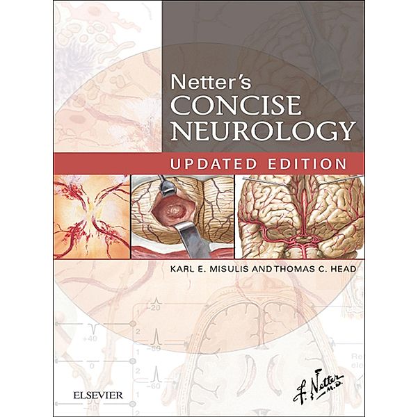 Netter's Concise Neurology Updated Edition E-Book, Karl E. Misulis, Thomas C. Head