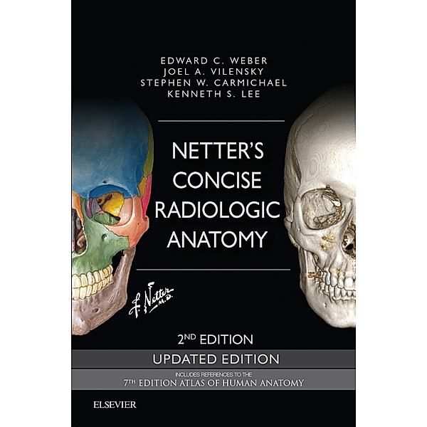 Netter's Concise Radiologic Anatomy Updated Edition E-Book, Edward C. Weber, Joel A. Vilensky, Stephen W. Carmichael