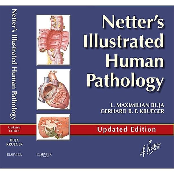 Netter's Illustrated Human Pathology Updated Edition E-book, L. Maximilian Buja, Gerhard R. F. Krueger