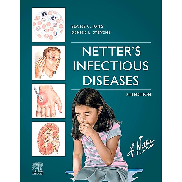 Netter's Infectious Diseases - E-Book, Elaine C. Jong, Dennis L. Stevens