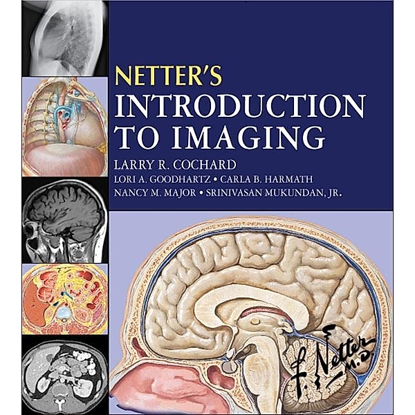 Netter's Introduction to Imaging E-Book, Larry R. Cochard, Lori A Goodhartz, Carla Harmath, Nancy M. Major, Srinivasan Mukundan