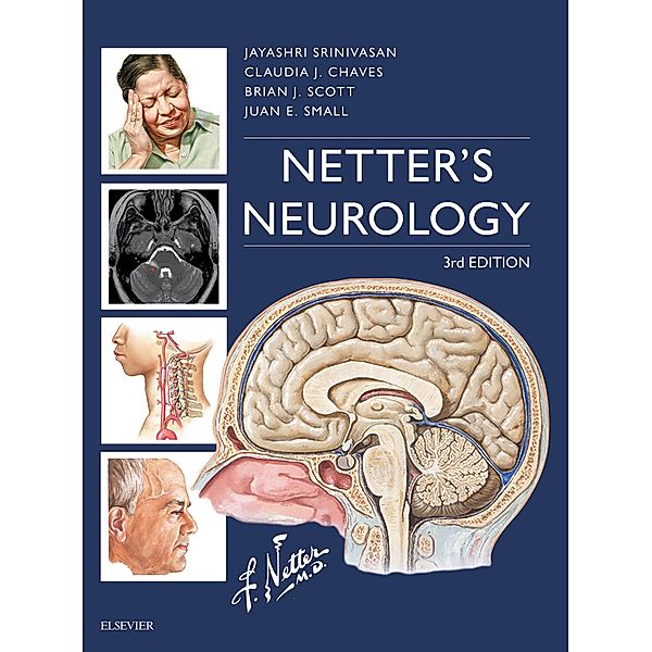 Netter's Neurology E-Book
