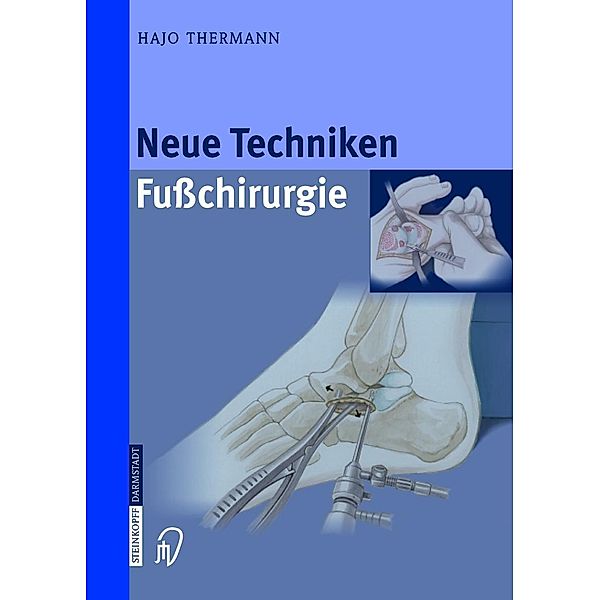Neue Techniken Fusschirurgie, Hajo Thermann