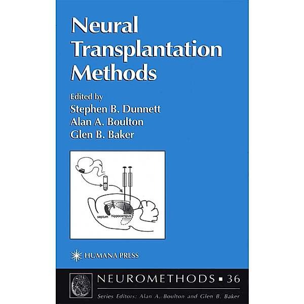 Neural Transplantation Methods