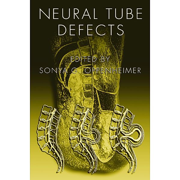 Neural Tube Defects