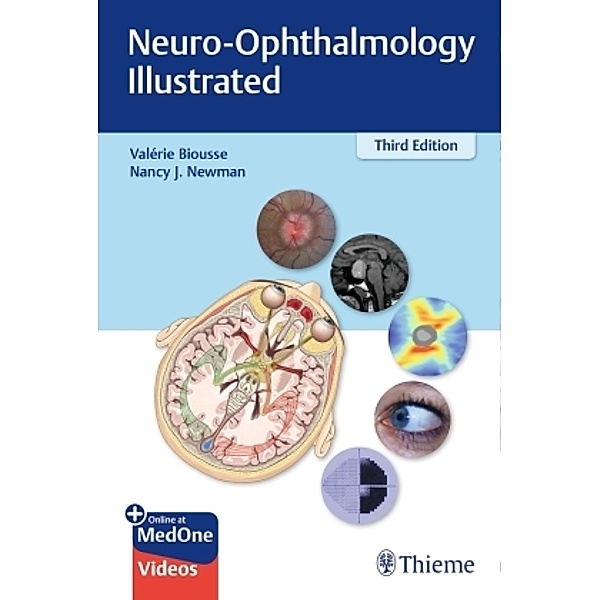 Neuro-Ophthalmology Illustrated, Valerie Biousse, Nancy Newman
