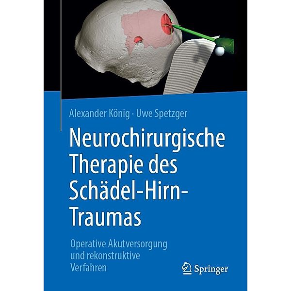 Neurochirurgische Therapie des Schädel-Hirn-Traumas, Alexander König, Uwe Spetzger