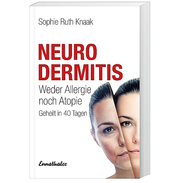 Neurodermitis, Sophie R. Knaak