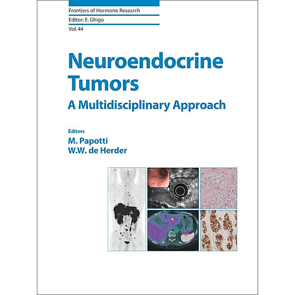 Neuroendocrine Tumors: A Multidisciplinary Approach