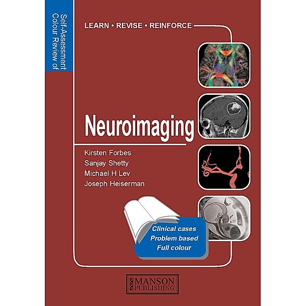 Neuroimaging, Kirsten Forbes, Sanjay Shetty, Michael Lev, Joseph Heiserman