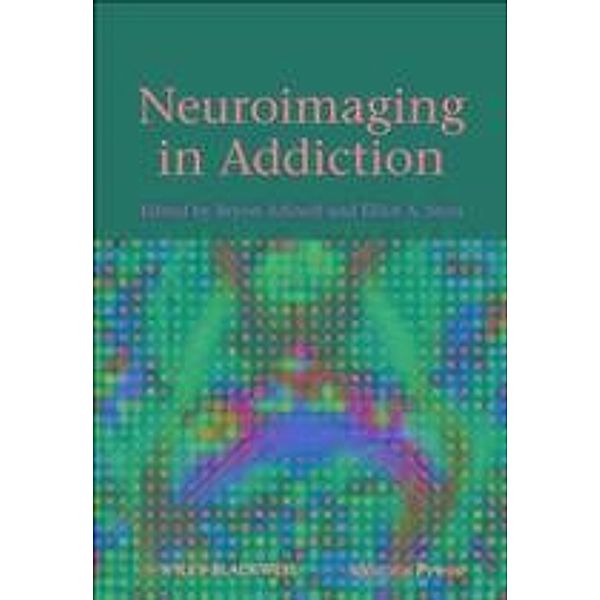 Neuroimaging in Addiction