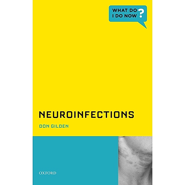 Neuroinfections, Don Gilden