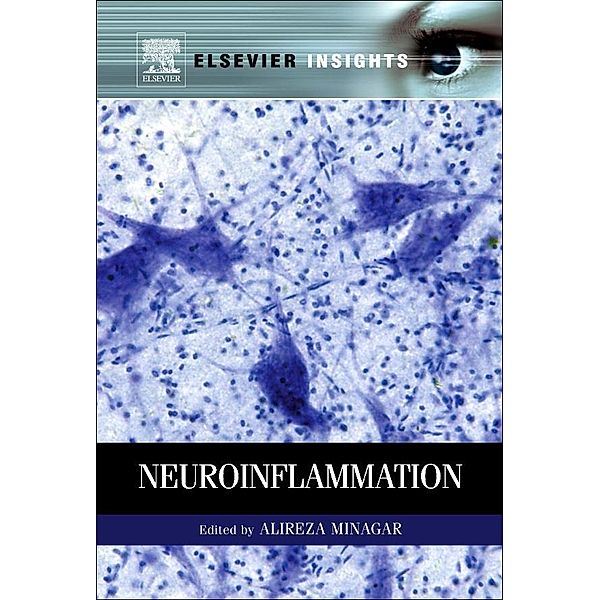 Neuroinflammation