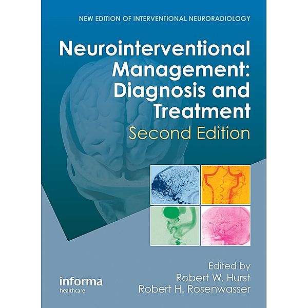 Neurointerventional Management