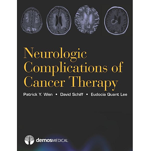 Neurologic Complications of Cancer Therapy, Eudocia Quant Lee, David Schiff, Patrick Y. Wen