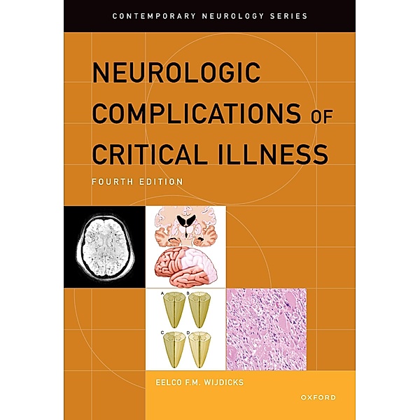 Neurologic Complications of Critical Illness, Eelco F. M. Wijdicks
