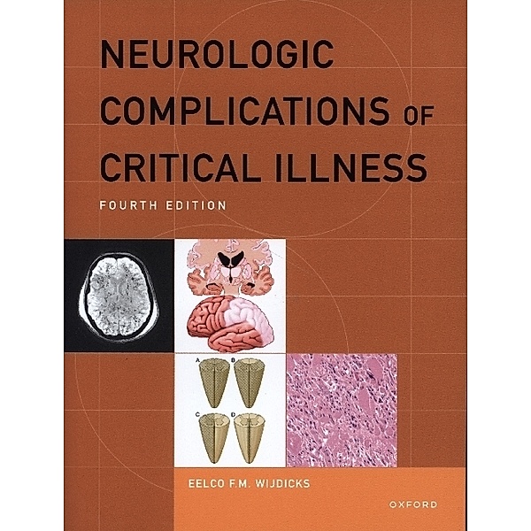 Neurologic Complications of Critical Illness, Eelco F.M. Wijdicks