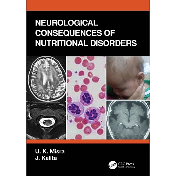 Neurological Consequences of Nutritional Disorders, U. K. Misra, J. Kalita