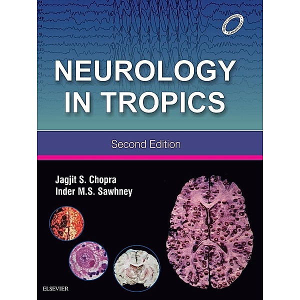 Neurology in Tropics (E-book)