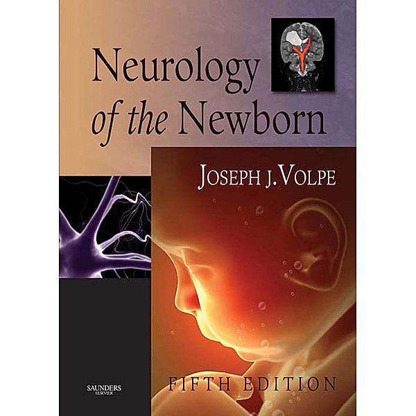 Neurology of the Newborn E-Book, Joseph J. Volpe