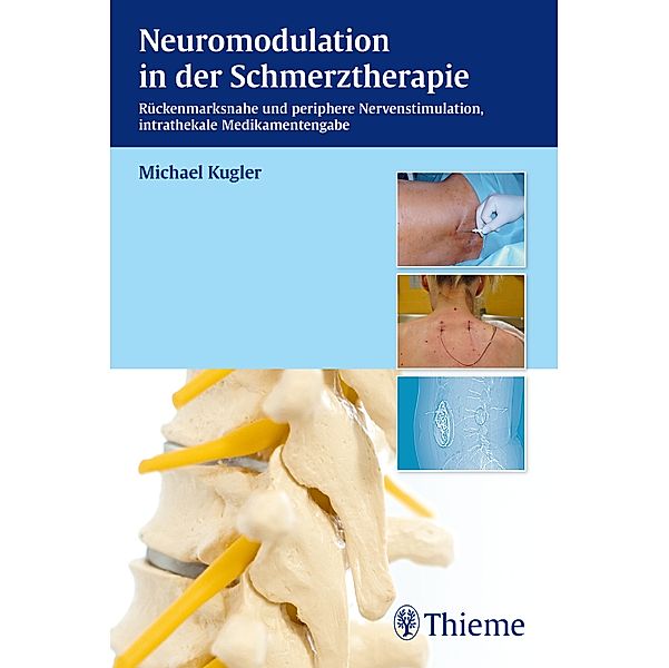 Neuromodulation in der Schmerztherapie, Michael Kugler