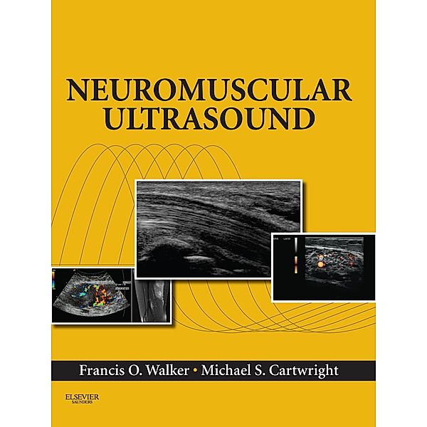 Neuromuscular Ultrasound E-Book, Francis Walker, Michael S. Cartwright