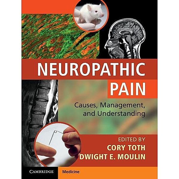 Neuropathic Pain