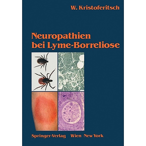Neuropathien bei Lyme-Borreliose, Wolfgang Kristoferitsch