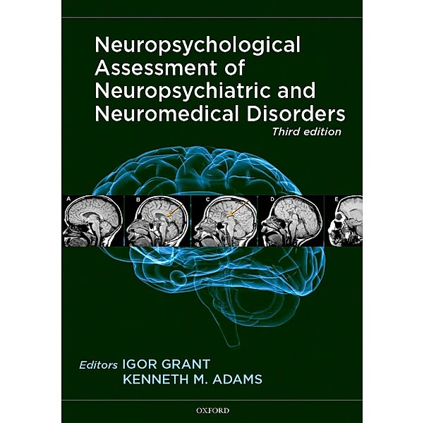 Neuropsychological Assessment of Neuropsychiatric and Neuromedical Disorders, Igor Grant, Kenneth Adams