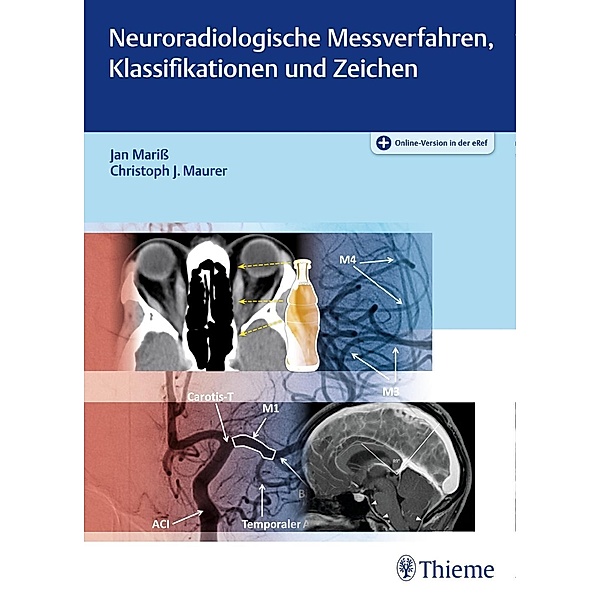 Neuroradiologische Messverfahren, Klassifikationen und Zeichen, Jan Mariß