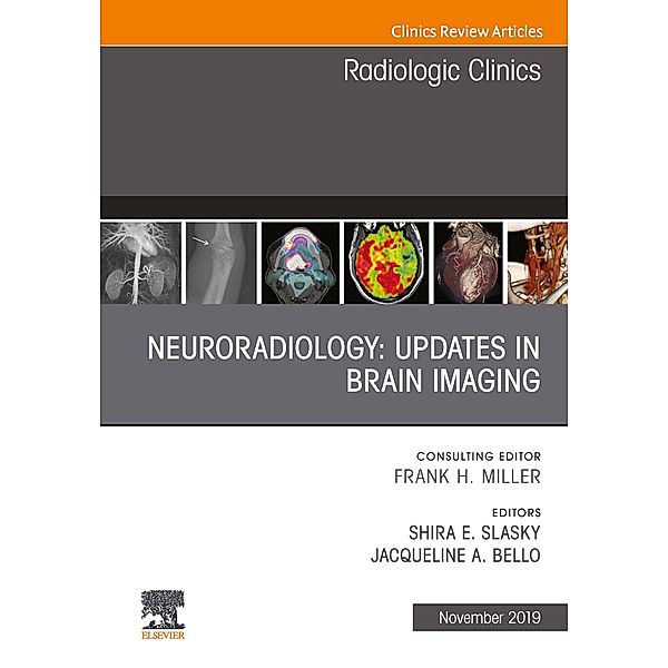 Neuroradiology, An Issue of Radiologic Clinics of North America, Jacqueline A Bello, Shira E. Slasky